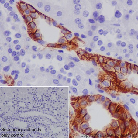 Immunohistochemistry (Formalin/PFA-fixed paraffin-embedded sections) - Anti-L1CAM antibody [EPR18998] - BSA and Azide free (AB240261), expandable thumbnail