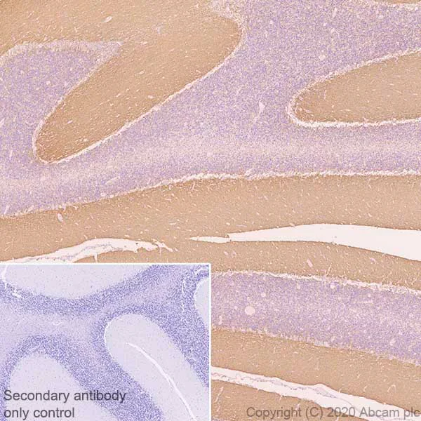 Immunohistochemistry (Formalin/PFA-fixed paraffin-embedded sections) - Anti-L1CAM antibody [EPR23241-224] - BSA and Azide free (AB272321)