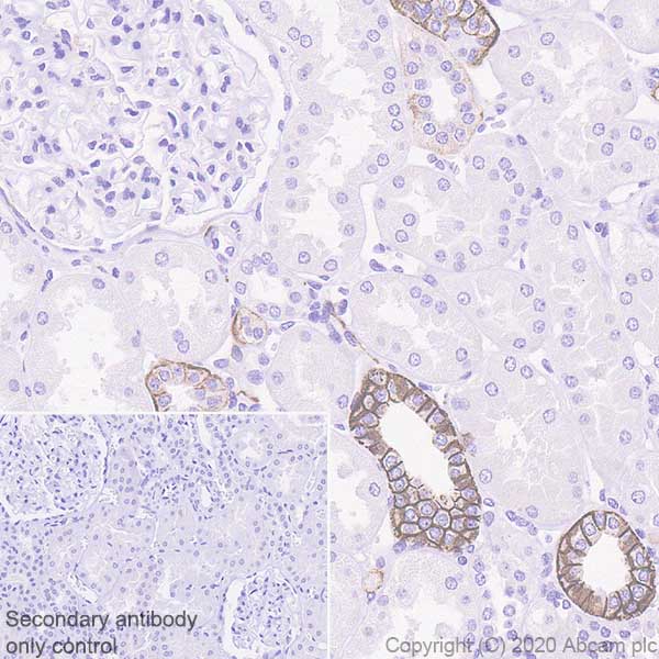 Immunohistochemistry (Formalin/PFA-fixed paraffin-embedded sections) - Anti-L1CAM antibody [EPR23241-224] - BSA and Azide free (AB272321)