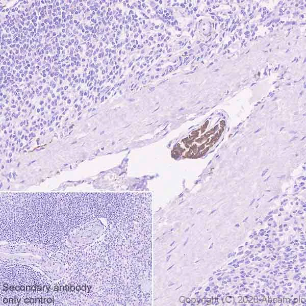 Immunohistochemistry (Formalin/PFA-fixed paraffin-embedded sections) - Anti-L1CAM antibody [EPR23241-224] - BSA and Azide free (AB272321)