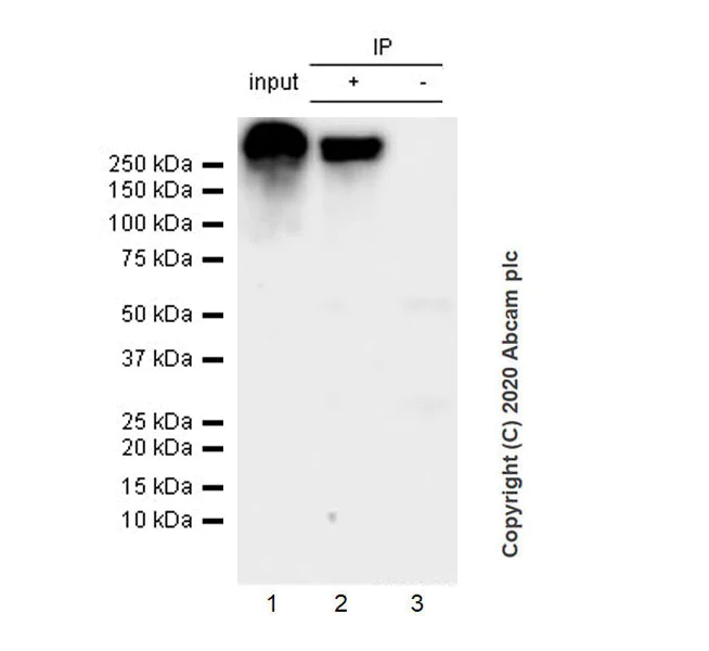 Immunoprecipitation - Anti-L1CAM antibody [EPR23241-224] - BSA and Azide free (AB272321)