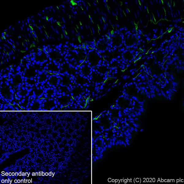 Immunohistochemistry (Frozen sections) - Anti-L1CAM antibody [EPR23338-106] - BSA and Azide free (AB273518)