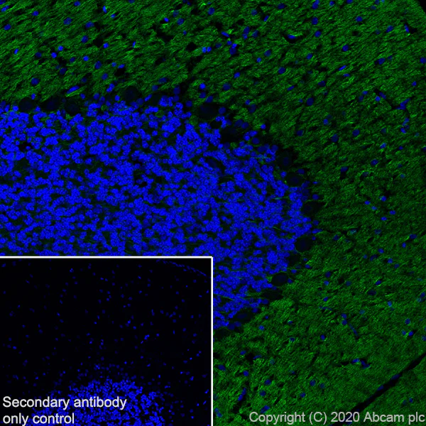 Immunohistochemistry (Frozen sections) - Anti-L1CAM antibody [EPR23338-106] - BSA and Azide free (AB273518)