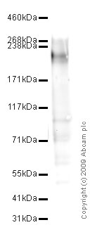 Western blot - Anti-L1CAM antibody [UJ127.11] (AB20148)
