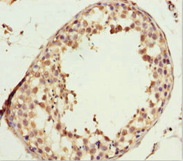 Immunohistochemistry (Formalin/PFA-fixed paraffin-embedded sections) - Anti-L2HGDH antibody (AB230230)