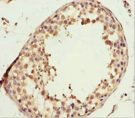 Immunohistochemistry (Formalin/PFA-fixed paraffin-embedded sections) - Anti-L2HGDH antibody (AB230230)