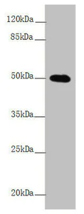 Western blot - Anti-L2HGDH antibody (AB230230)