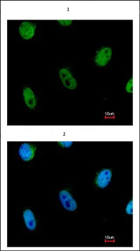 Immunocytochemistry/ Immunofluorescence - Anti-L3MBTL1 antibody (AB97304)