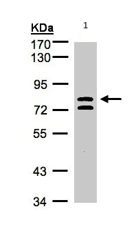Western blot - Anti-L3MBTL1 antibody (AB97304)