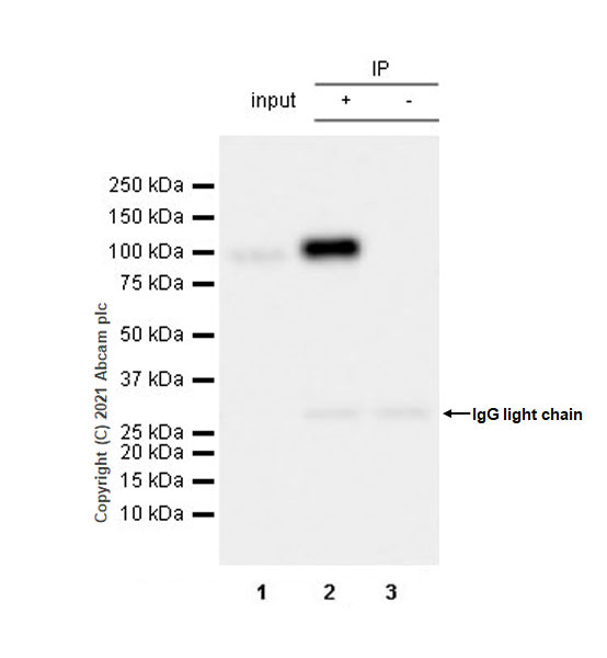 Immunoprecipitation - Anti-L3MBTL1 antibody [EPR23810-121] (AB259919), expandable thumbnail