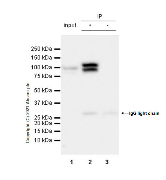 Immunoprecipitation - Anti-L3MBTL1 antibody [EPR23810-121] (AB259919), expandable thumbnail