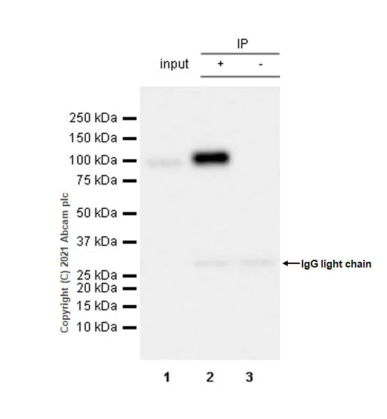Immunoprecipitation - Anti-L3MBTL1 antibody [EPR23810-121] - BSA and Azide free (AB281834)