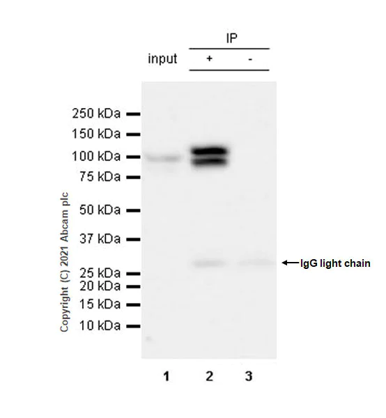 Immunoprecipitation - Anti-L3MBTL1 antibody [EPR23810-121] - BSA and Azide free (AB281834)