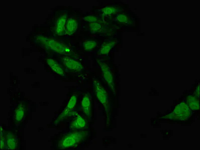 Immunocytochemistry/ Immunofluorescence - Anti-L3MBTL2 antibody (AB237628)