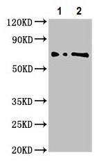Western blot - Anti-L3MBTL2 antibody (AB237628), expandable thumbnail