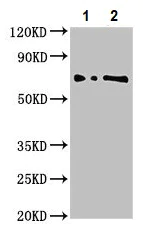 Western blot - Anti-L3MBTL2 antibody (AB237628)