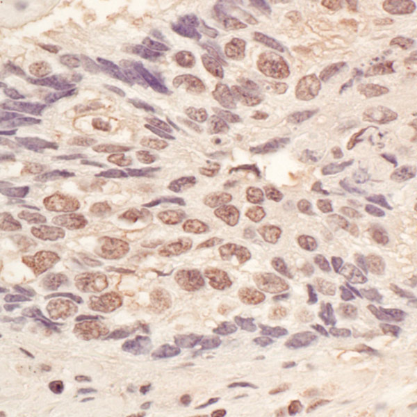 Immunohistochemistry (Formalin/PFA-fixed paraffin-embedded sections) - Anti-L3MBTL3 antibody (AB99928)