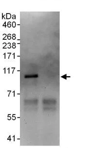 Immunoprecipitation - Anti-L3MBTL3 antibody (AB99928)