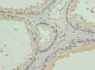 Immunohistochemistry (Formalin/PFA-fixed paraffin-embedded sections) - Anti-L3MBTL4 antibody (AB235089)