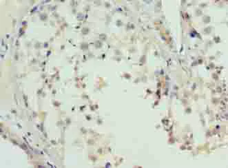 Immunohistochemistry (Formalin/PFA-fixed paraffin-embedded sections) - Anti-L3MBTL4 antibody (AB235089)