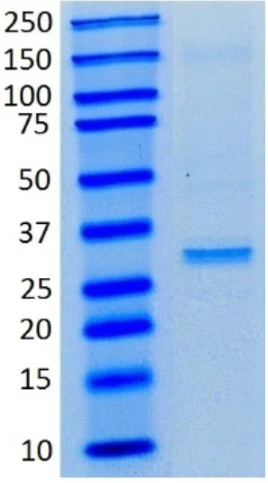 Immunoprecipitation - Anti-Lactate Dehydrogenase antibody [98A-1F9BB1] (AB135396)