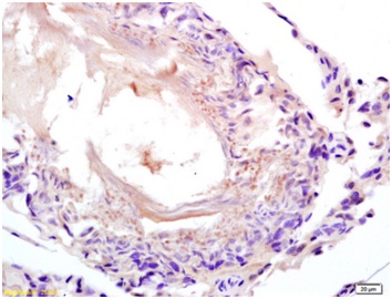 Immunohistochemistry (Formalin/PFA-fixed paraffin-embedded sections) - Anti-Lactate Dehydrogenase antibody (AB203285), expandable thumbnail