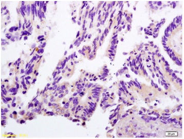 Immunohistochemistry (Formalin/PFA-fixed paraffin-embedded sections) - Anti-Lactate Dehydrogenase antibody (AB203285), expandable thumbnail