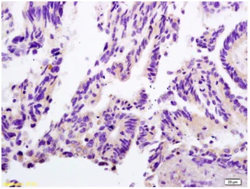 Immunohistochemistry (Formalin/PFA-fixed paraffin-embedded sections) - Anti-Lactate Dehydrogenase antibody (AB203285)