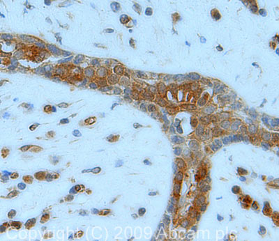 Immunohistochemistry (Formalin/PFA-fixed paraffin-embedded sections) - Anti-Lactate Dehydrogenase antibody (AB47010)