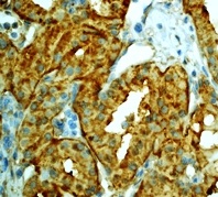 Immunohistochemistry (Formalin/PFA-fixed paraffin-embedded sections) - Anti-Lactate Dehydrogenase antibody [EP1563Y] (AB134187)