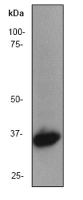 Western blot - Anti-Lactate Dehydrogenase antibody [EP1566Y] (ab52488), expandable thumbnail