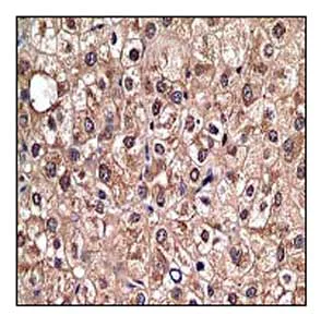 Immunohistochemistry (Formalin/PFA-fixed paraffin-embedded sections) - Anti-Lactate Dehydrogenase antibody [EP1566Y] - BSA and Azide free (AB219591)