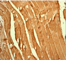 Immunohistochemistry (Formalin/PFA-fixed paraffin-embedded sections) - Anti-Lactate Dehydrogenase antibody [EPR1564] (AB101562), expandable thumbnail