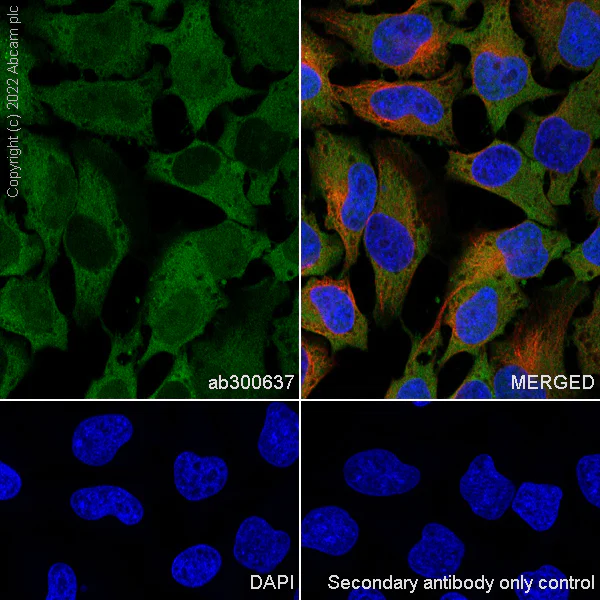 Immunocytochemistry/ Immunofluorescence - Anti-Lactate Dehydrogenase antibody [RM1039] (AB300637)