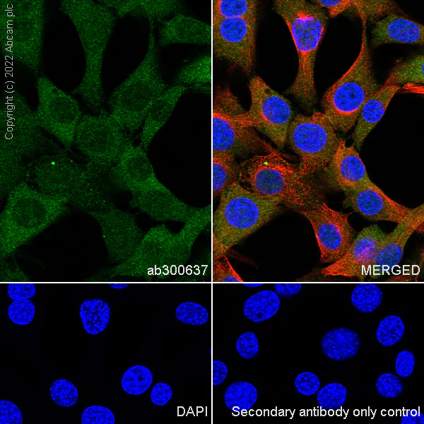Immunocytochemistry/ Immunofluorescence - Anti-Lactate Dehydrogenase antibody [RM1039] (AB300637)