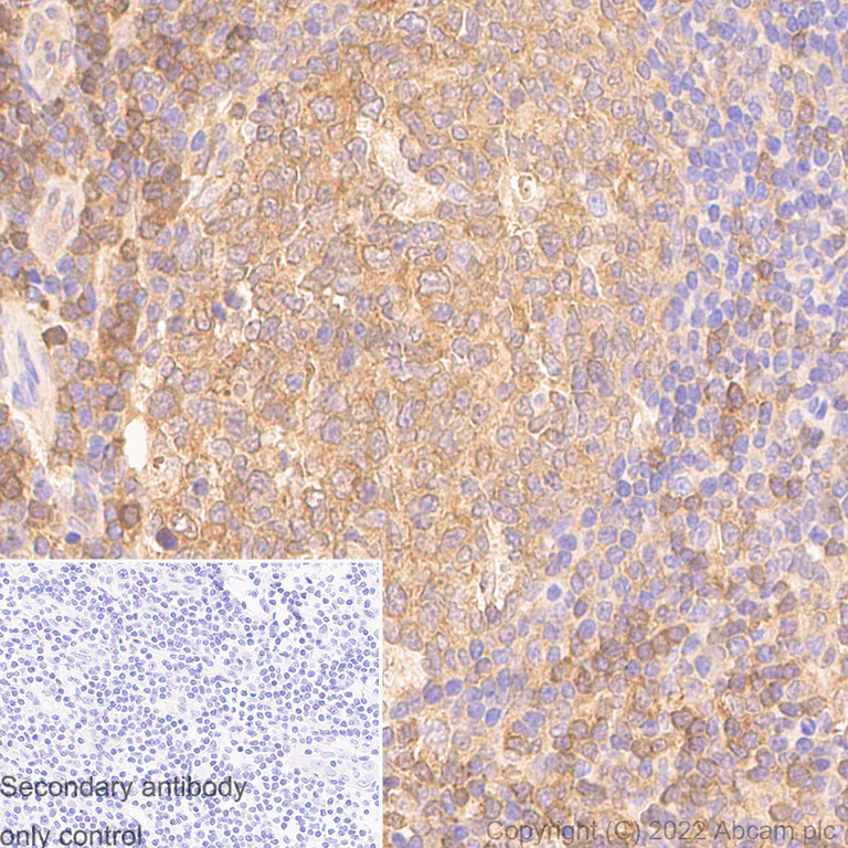 Immunohistochemistry (Formalin/PFA-fixed paraffin-embedded sections) - Anti-Lactate Dehydrogenase antibody [RM1039] (AB300637)