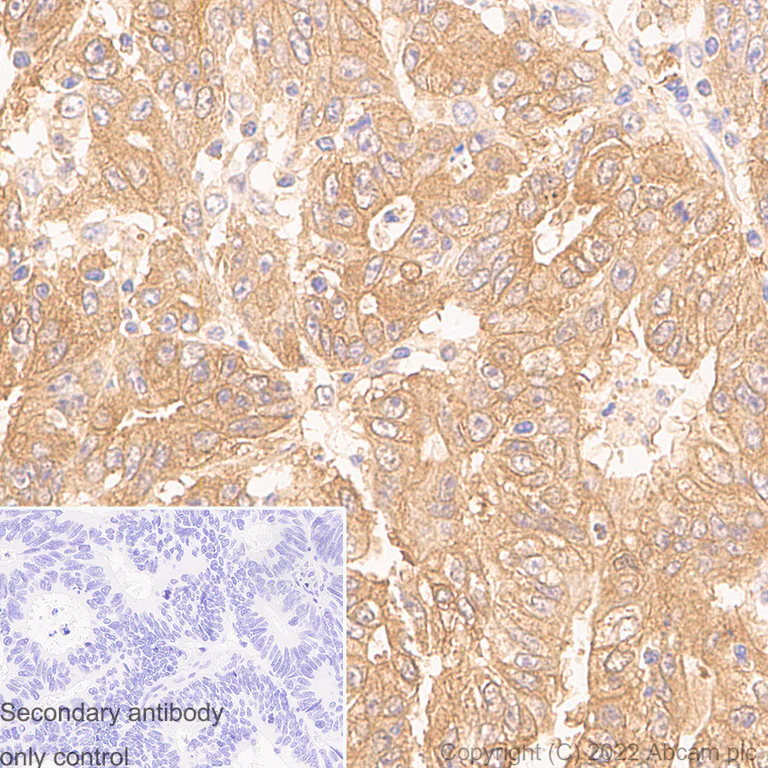 Immunohistochemistry (Formalin/PFA-fixed paraffin-embedded sections) - Anti-Lactate Dehydrogenase antibody [RM1039] (AB300637)