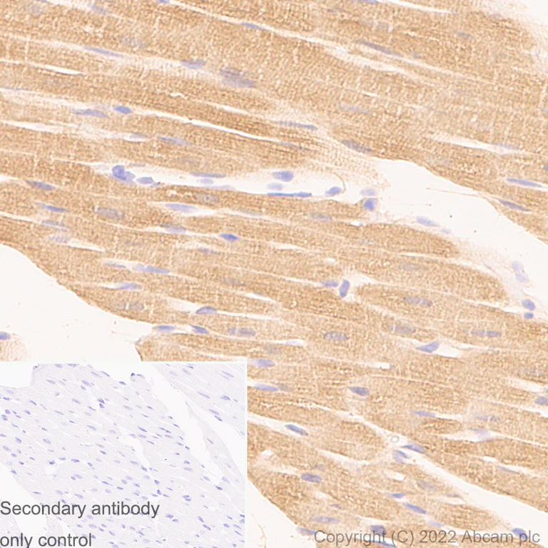 Immunohistochemistry (Formalin/PFA-fixed paraffin-embedded sections) - Anti-Lactate Dehydrogenase antibody [RM1039] (AB300637)