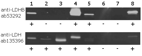 Western blot - Lactate Dehydrogenase B / LDH-B Activity Assay (AB140361), expandable thumbnail