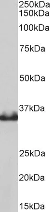 Western blot - Anti-Lactate Dehydrogenase B/LDH-B antibody (AB240482)