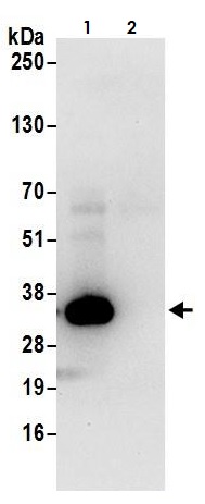 Immunoprecipitation - Anti-Lactate Dehydrogenase B/LDH-B antibody (AB264358), expandable thumbnail
