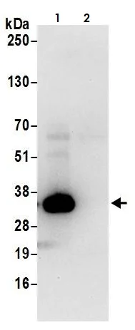 Immunoprecipitation - Anti-Lactate Dehydrogenase B/LDH-B antibody (AB264358)