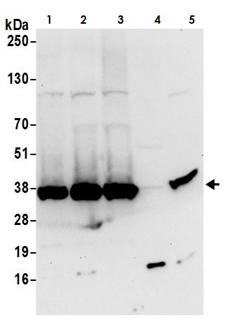 Western blot - Anti-Lactate Dehydrogenase B/LDH-B antibody (AB264358), expandable thumbnail