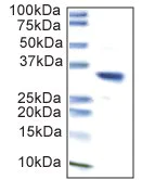Immunoprecipitation - Anti-Lactate Dehydrogenase LDHA + LDHB antibody [10E6AA9] (AB112996)