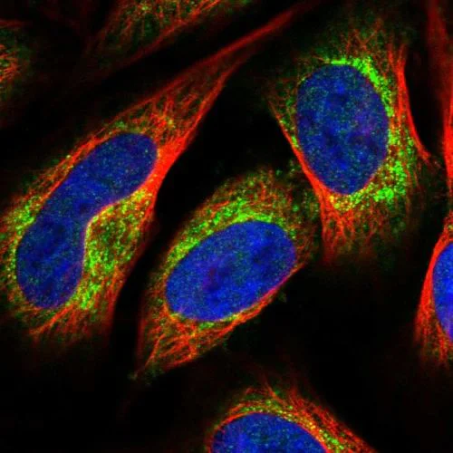 Immunocytochemistry/ Immunofluorescence - Anti-LACTB antibody (AB244455)