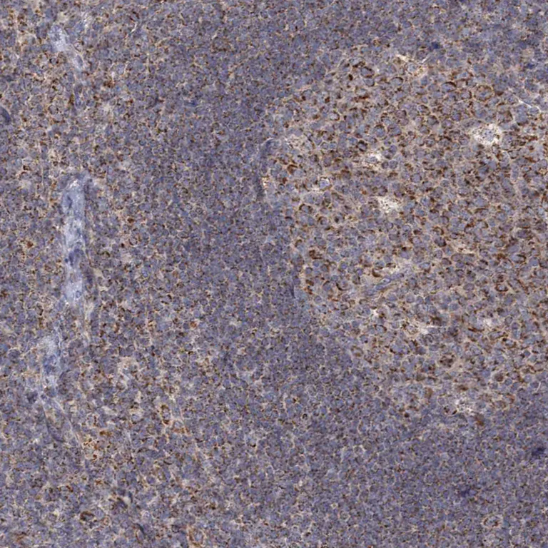 Immunohistochemistry (Formalin/PFA-fixed paraffin-embedded sections) - Anti-LACTB antibody (AB244455)