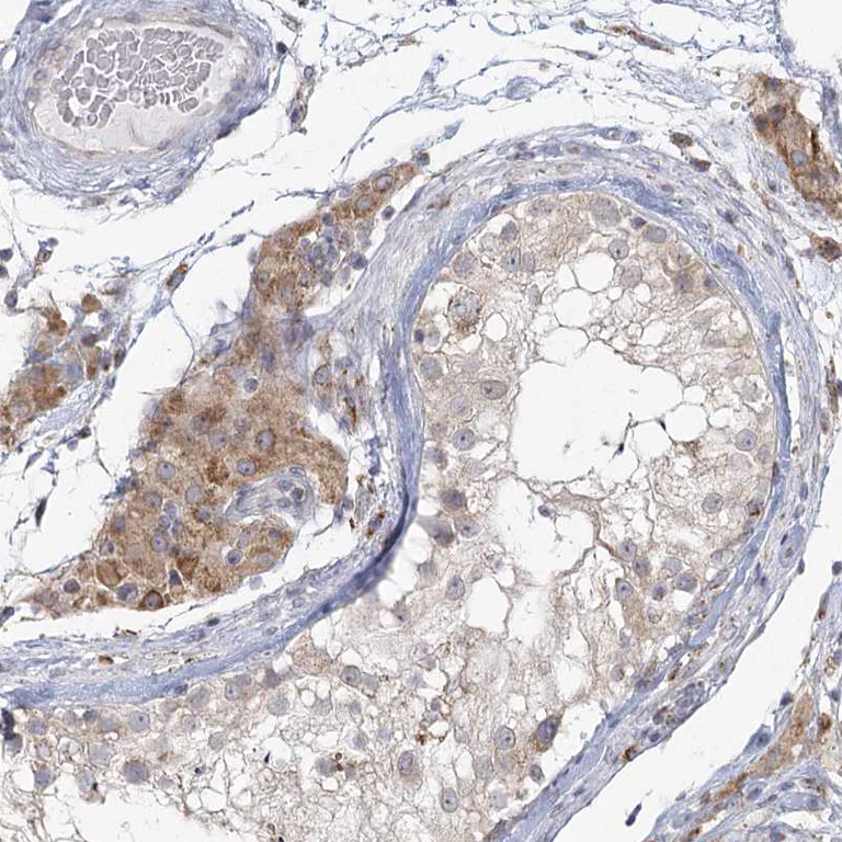 Immunohistochemistry (Formalin/PFA-fixed paraffin-embedded sections) - Anti-LACTB antibody (AB244455)