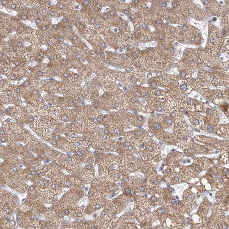 Immunohistochemistry (Formalin/PFA-fixed paraffin-embedded sections) - Anti-LACTB antibody (AB244455)