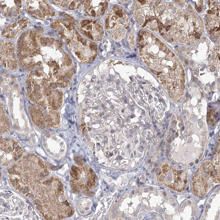 Immunohistochemistry (Formalin/PFA-fixed paraffin-embedded sections) - Anti-LACTB antibody (AB244455)