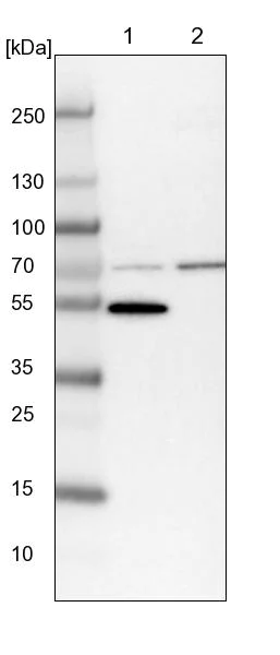 Western blot - Anti-LACTB antibody (AB244455)